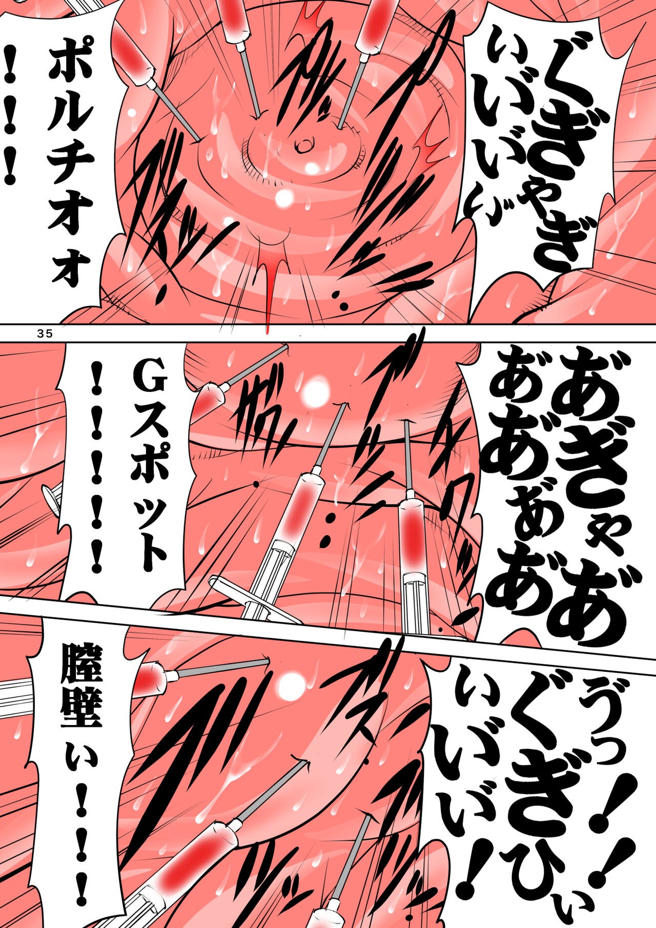 Page 35