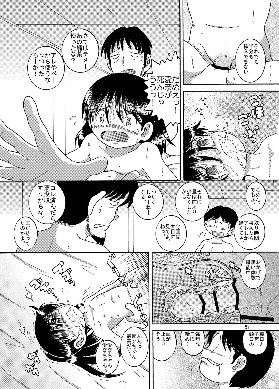 Page 52
