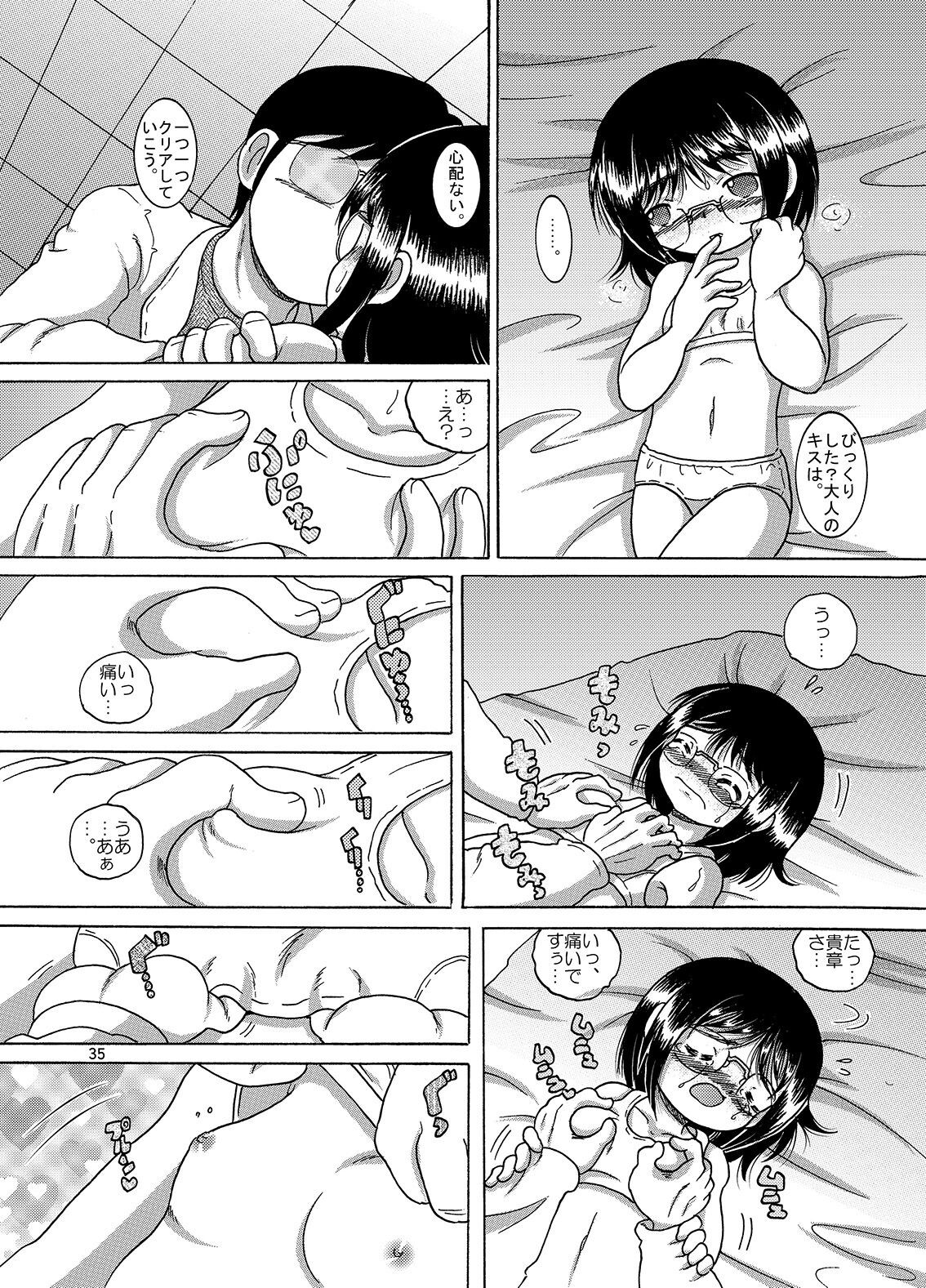 Page 35