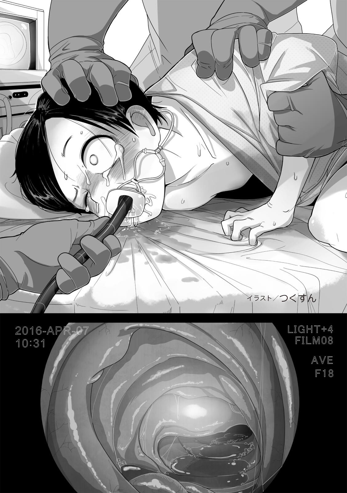 Page 57