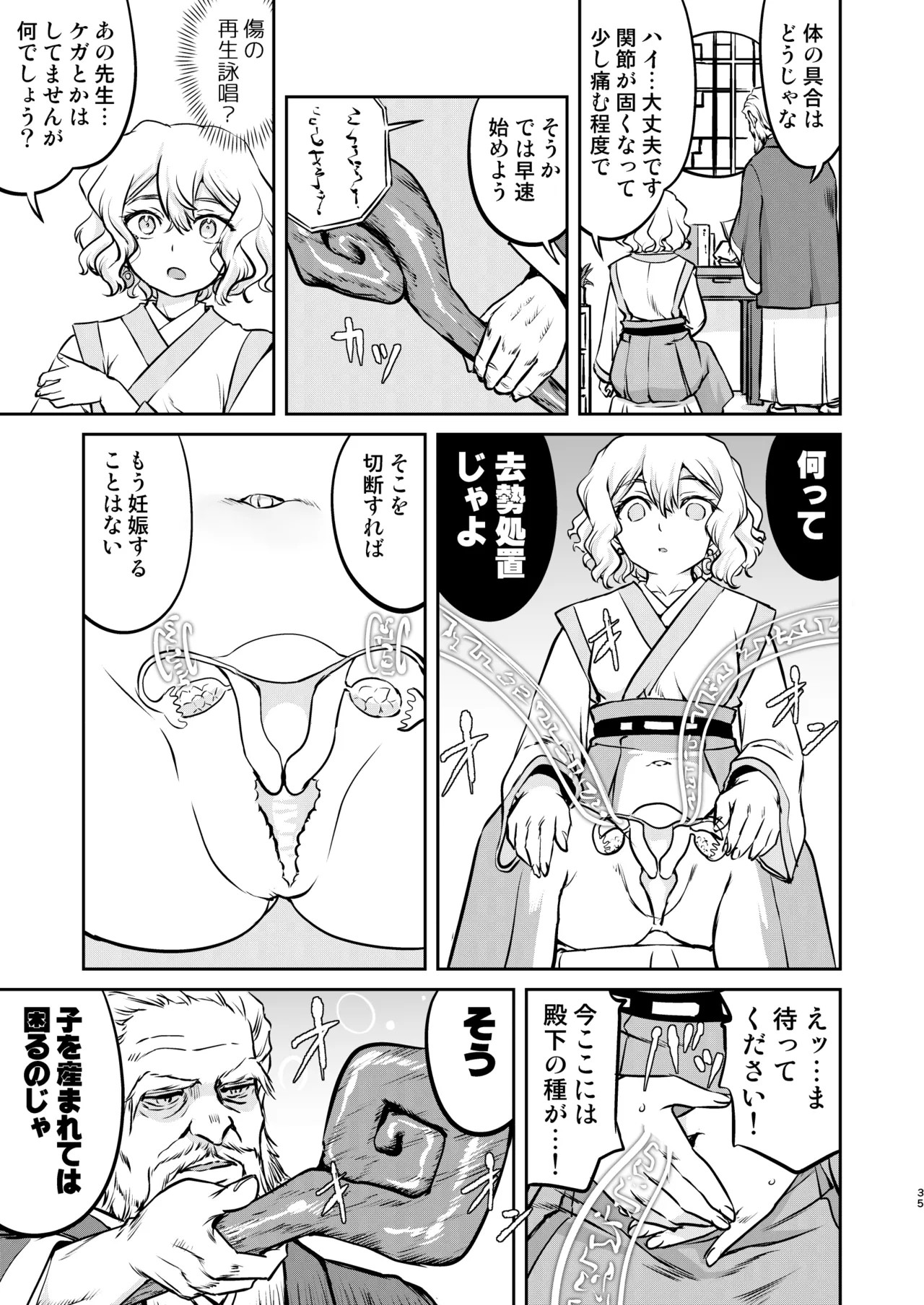 Page 35